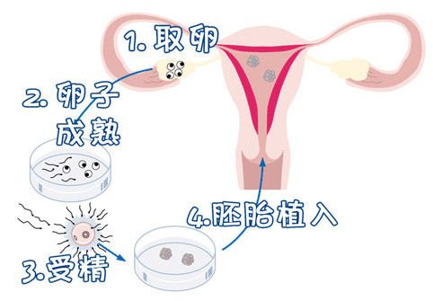 遗传咨询